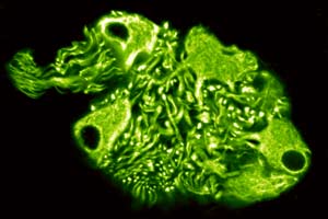 Ganglion in human urinary bladder, detected by indirect FITC immunofluorescence and antibodies to neurofilament proteins. (c) Univ.-Prof. Dr. Gerhard W. Hacker, Salzburg.